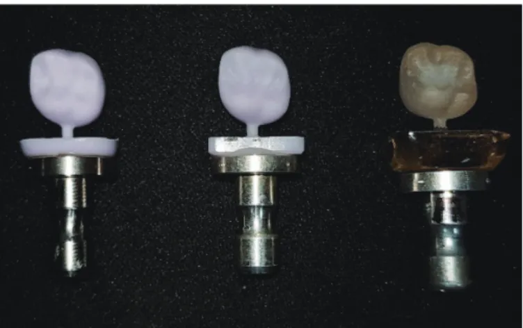 Fig. 3. Procedure for evaluating machining precision. (A) Contact scanning of intaglio surface, (B)  A crown designed model