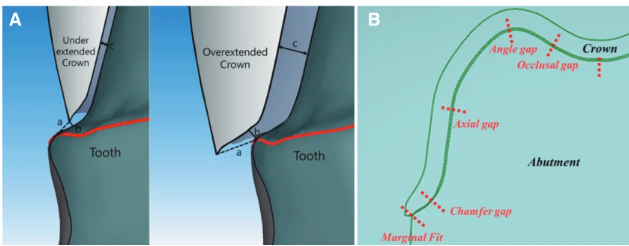 Fig. 5. Results of machining precision according to the type of lithium disili- disili-cate ceramic blocks