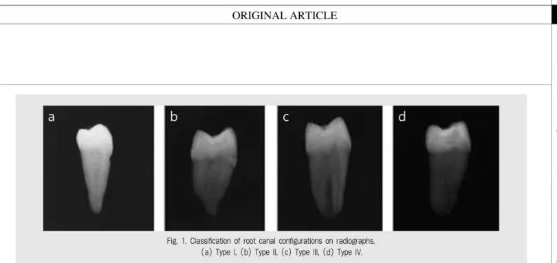 Fig. 1. Classification of root canal configurations on radiographs.