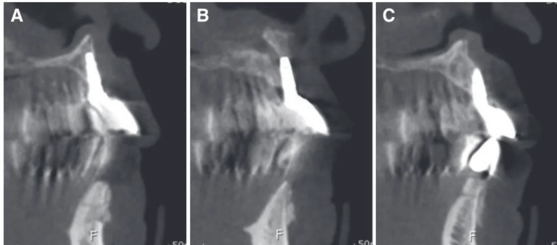 Fig. 1. Extraoral photograph before 