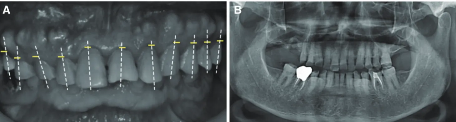 Fig. 3. TMJ series before treatment. (A) Rt. close, (B) Rt. opening, (C) Lt. 