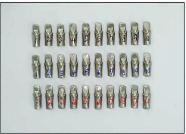 Fig. 3. fabrication of zirconia cores. Fig. 4. Cementation of cores.