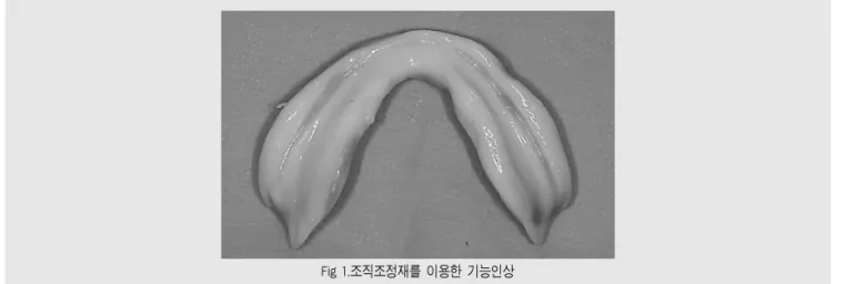 Fig 1.조직조정재를 이용한 기능인상