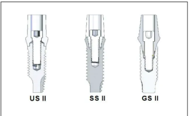 Fig.  1. Sectional  views  of  three  implant  sys- sys-tems  showing  interface  and  attached   abut-ment.