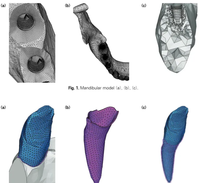 Fig. 1. Mandibular model (a), (b), (c).