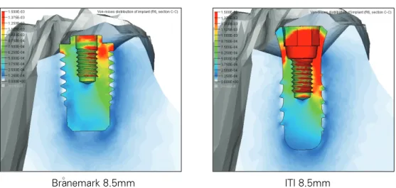 Fig. 8. Comparison of Internal &amp; External type implant (Horizontal load). 