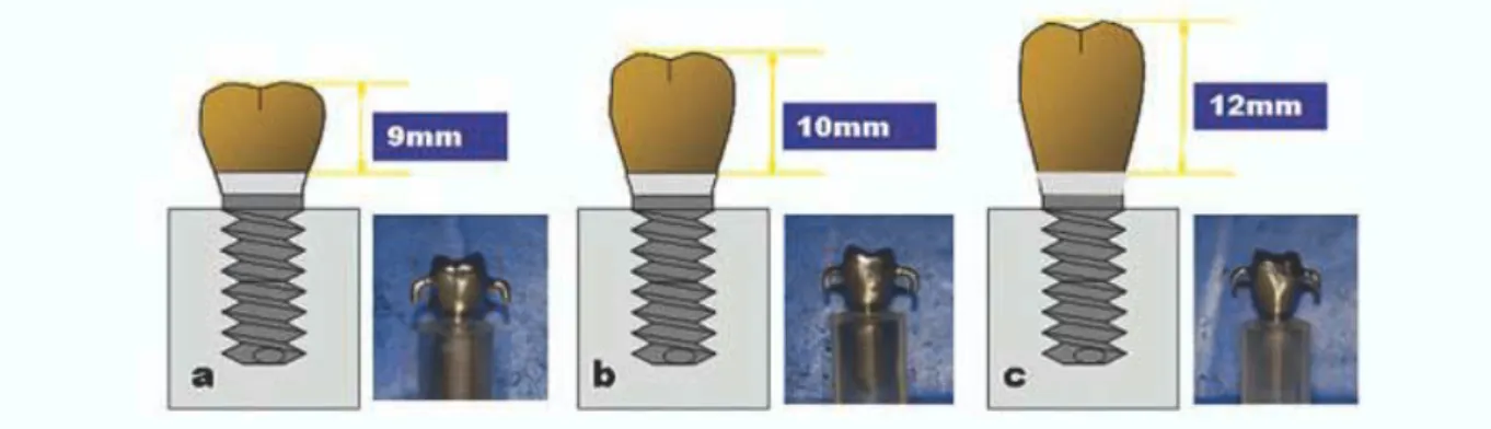 Fig. 3. Casting crowns of 9 mm (a), 10 mm (b), and 12 mm (c).