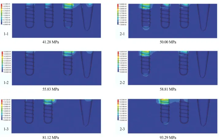Fig. 3. Stresses distribution and maximum von Mises stress.