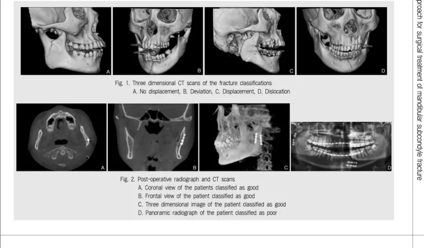 Fig. 2. Post-operative radiograph and CT scans  A. Coronal view of the patients classified as good B