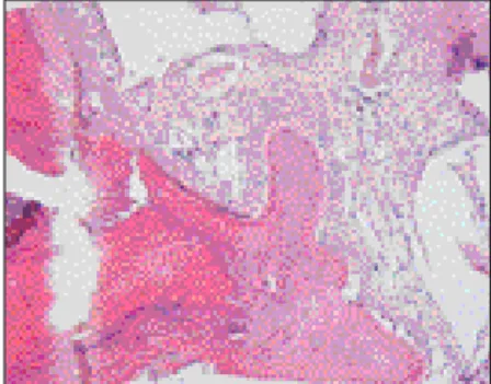 Fig. 10. NOVX &amp; OSTEON TM group (×200) (This is host bone area.) 