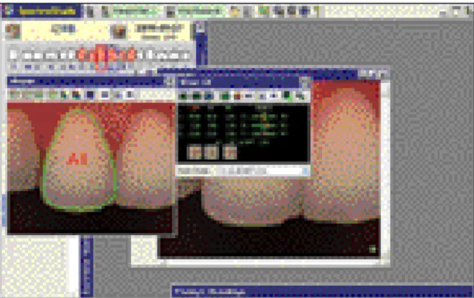 Fig. 3. A Sample of Digital shade map.