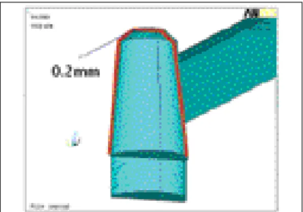 Fig. 3. Modeling of outer crown and connector. Fig. 4. Relationship between outer crown and abutment.