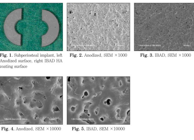 Fig. 1. Subperiosteal implant, left Anodized surface, right IBAD HA coating surface
