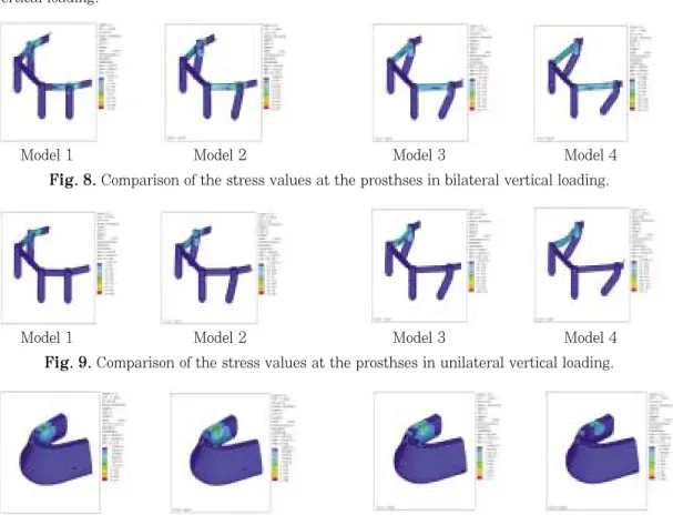 Fig. 10. Comparison of the stress values at the surface layer of the cortical and cancellous bone in unilateral obligue loading.