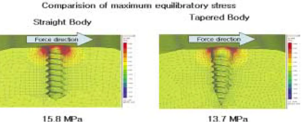 Fig. 2. Diagram of maximum equilibratory stesses in two types of orthodontic miniscrews with linear finite element method.