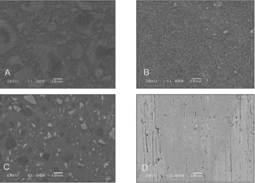 Table IV. Mean values and SDs of wear track width of indirect composite resins and gold alloy (mm)