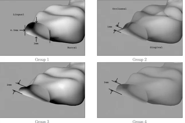 Fig. 3. Cross sectional views between 1st molar and 2nd molar. 