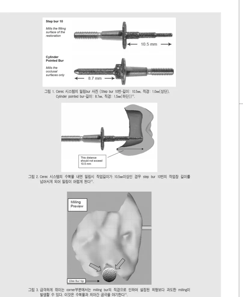 그림 1. Cerec 시스템의 밀링bur 사진 (Step bur 10번-길이: 10.5㎜, 직경: 1.0㎜(상단), Cylinder pointed bur-길이: 8.7㎜, 직경: 1.5㎜(하단)) 13) 