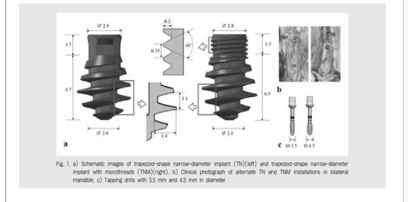 Fig. 1. a) Schematic images of trapezoid-shape narrow-diameter implant (TN)(left) and trapezoid-shape narrow-diameter implant with microthreads (TNM)(right)