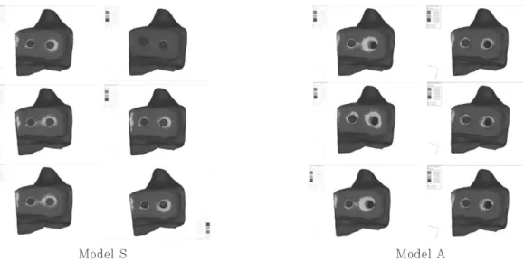 Fig. 5. Cervical sectional view of stress contour on Model S and A under Load condition 1: non- non-splinted and non-splinted situations(left to right) ; C/R ratio 0.7:1, 1:1 and 1.25:1(top to bottom).