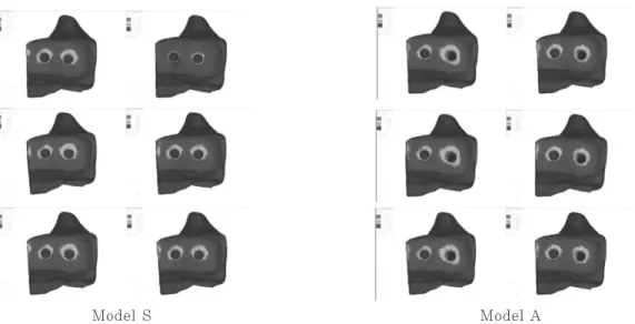 Fig. 7. Cervical sectional view of stress contour on Model S and A under Load condition 2: non- non-splinted and non-splinted situations(left to right) ; C/R ratio 0.7:1, 1:1 and 1.25:1(top to bottom).