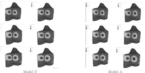 Fig. 12. Maximum von Mises stress under Load condition 1 (MPa) ;