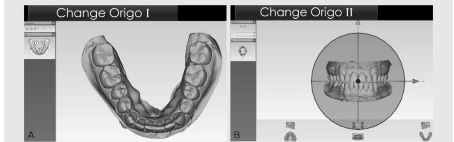 Fig. 2. Tooth segmentation. A, By selecting four points along the gingival margin of each tooth, preliminary tooth segmentation is done