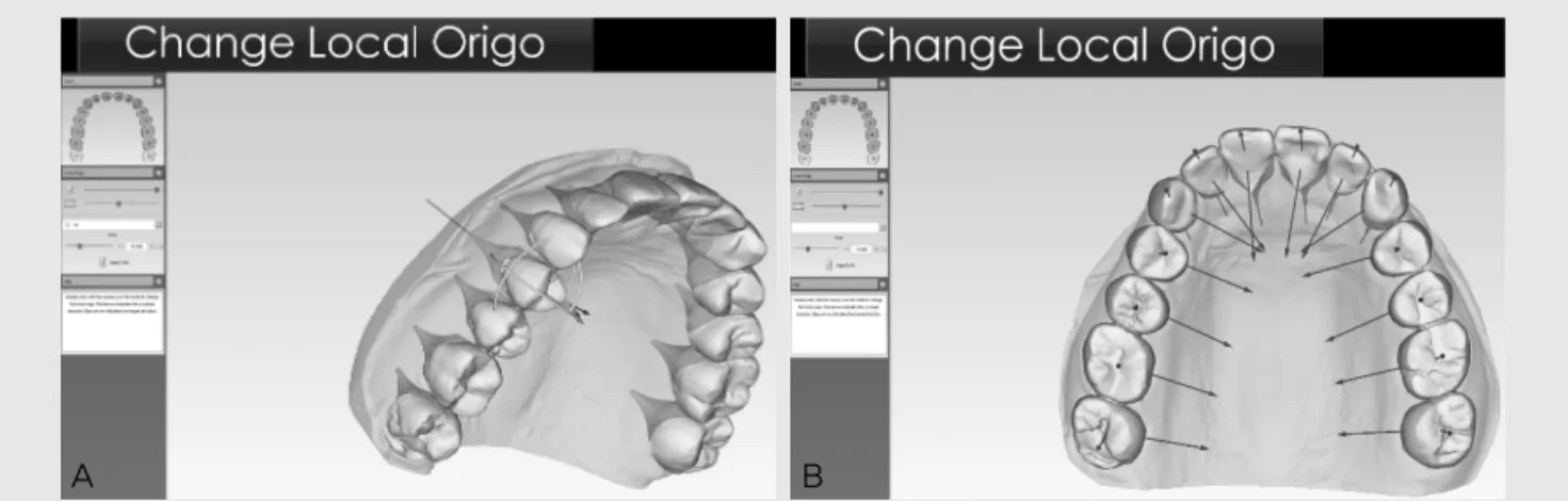 Fig. 3. Orientation of the long axis of each tooth. A, Adjustment of long axis of individual tooth