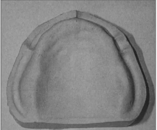 Fig. 3. Silicone mold for duplication of stone cast. Fig. 4. The master cast stone.