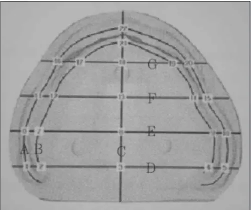 Fig. 8. Sectioning of the cast and denture on the computer screen (22 points).