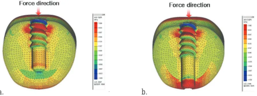 Fig. 9. Principal stress distribution.