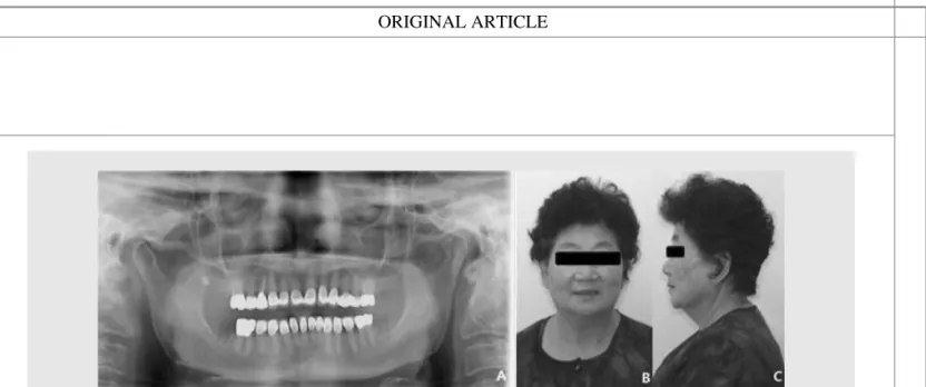 Fig. 8. Post-treatment radiographic and facial view. A: Panoramic view, B: Frontal view, C: Lateral view.