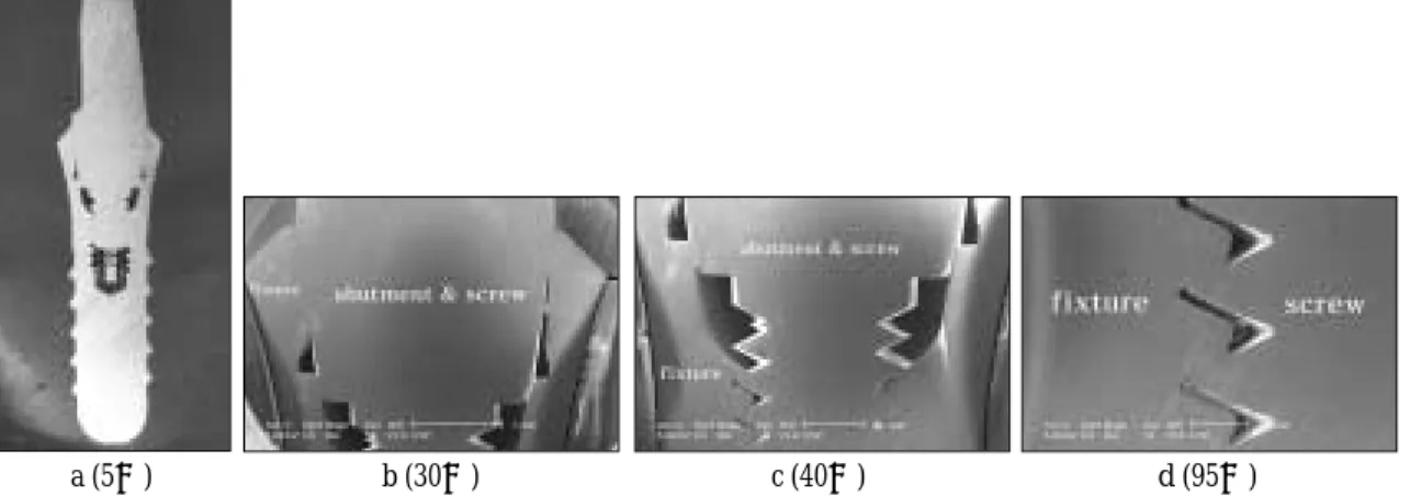 Fig. 12. Optical cross-section micrograph (a) and SEM (b, c, d) of joint connection in Implantium (1 piece) implant system.