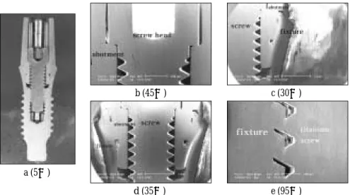 Fig. 6. Optical cross-section micrograph (a) and SEM (b, c, d, e) of joint connection in AVANA (2 piece-titanium screw) implant system.