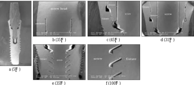 Fig. 8. Optical cross-section micrograph (a) and SEM (b, c, d e, f) of joint connection in Bioplant (2 piece) implant system.