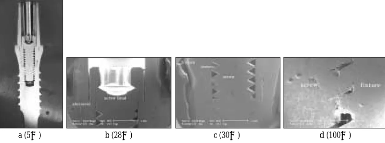 Fig. 10. Optical cross-section micrograph (a) and SEM (b, c, d) of joint connection in Dio (2 piece) implant system.