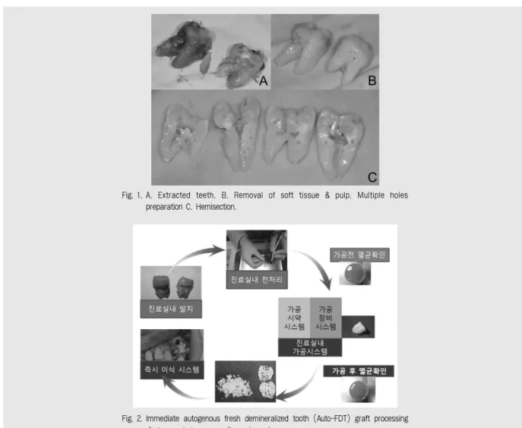 Fig. 1. A.  Extracted  teeth.  B.  Removal  of  soft  tissue  &amp;  pulp.  Multiple  holes preparation C