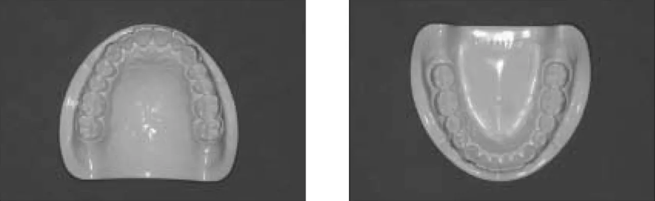 Fig. 1. Master model of maxilla and mandible.