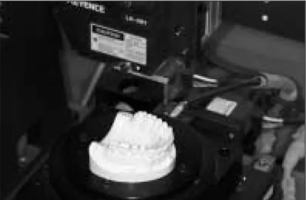 Fig. 4. Reference points &amp; scanned image of maxilla.