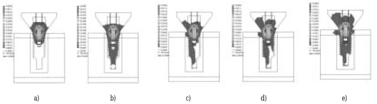 Fig. 7. The von Mises stress  pattern without platform switching.