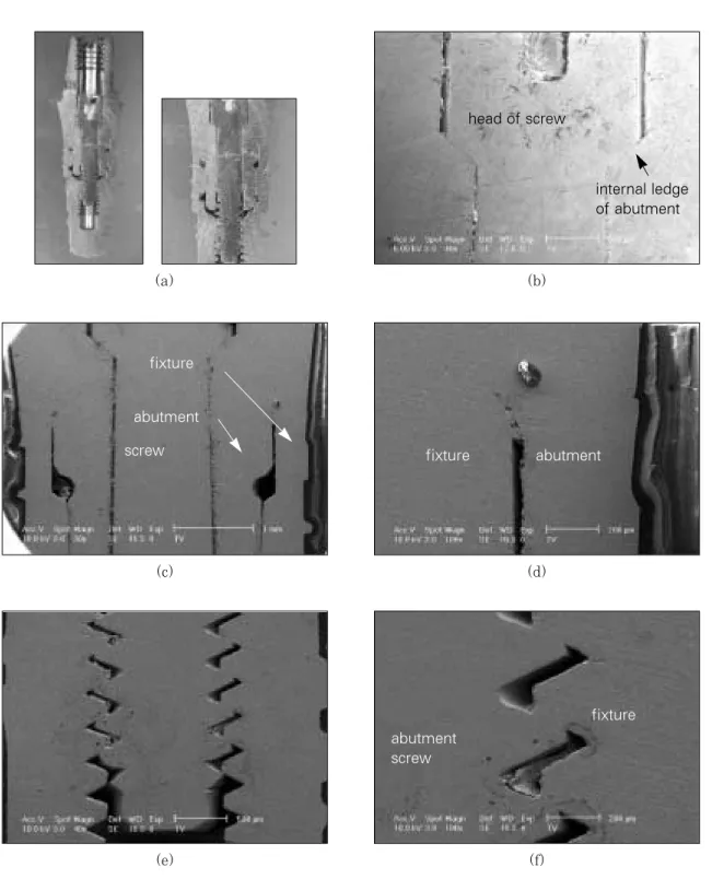 Fig. 8. Optical  cross-sectional  micrograph  (a)  and  SEM  (b,c,d,e,f)  of  implant/abutment  connection  in Friadent implant system.