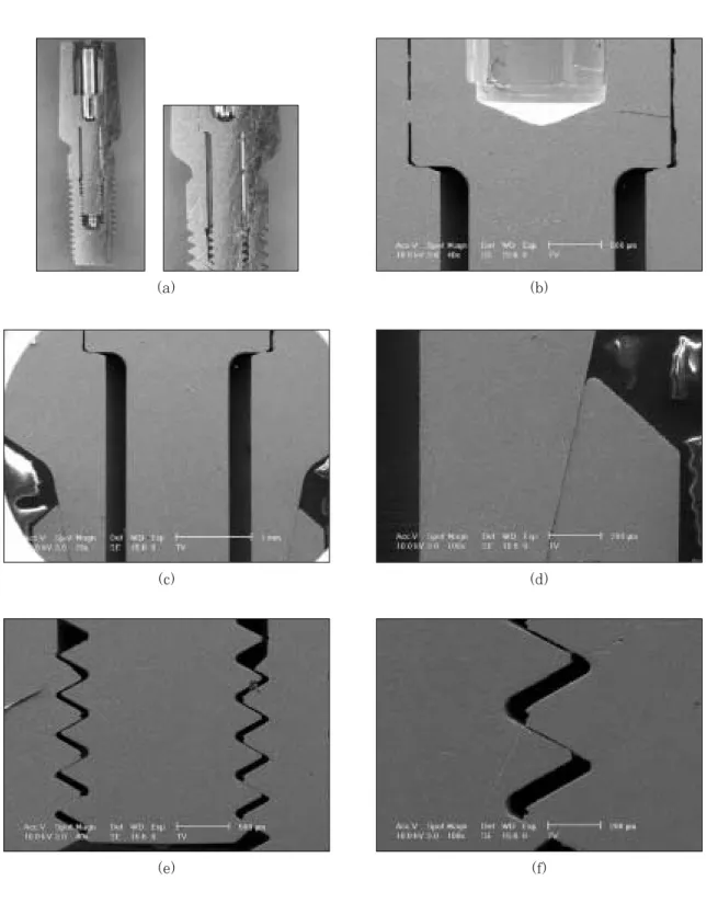 Fig. 9. Optical  cross-sectional  micrograph  (a)  and  SEM  (b,c,d,e,f)  of  implant/abutment  connection  in Astra implant system.