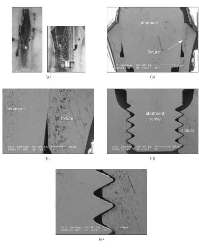 Fig. 4. Optical cross-sectional micrograph (a) and SEM (b,c,d,e) of implant/abutment connection in ITI implant system