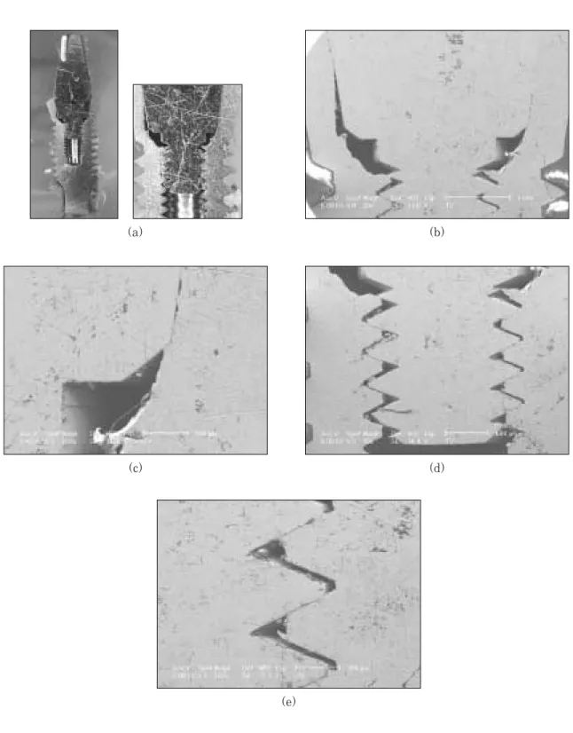 Fig. 6. Optical cross-sectional micrograph (a) and SEM (b,c,d,e) of implant/abutment connection in Avana implant system