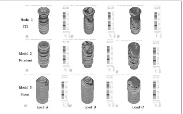 Fig. 10. The stress contour of the fixture in model under loading condition A, B, C.