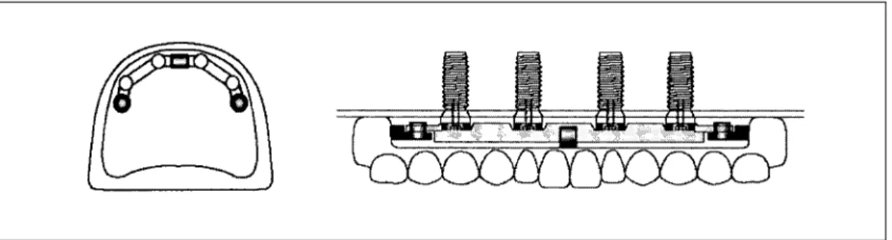 Fig. 4. Anchorage system of type 4. 