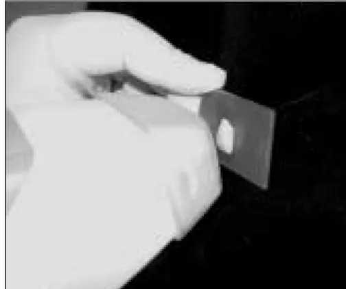 Fig. 1. ShadeScan ™ System Fig. 2. Measuring process