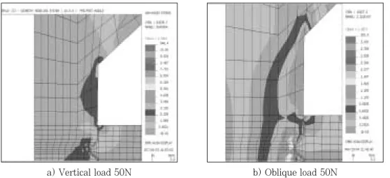 Fig. 11. Stress distribution at cervical bone of Model 5.