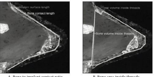Fig. 2 A-I illustrated a ground-section of an implant with surrounding hard tissues from biopsy sampled