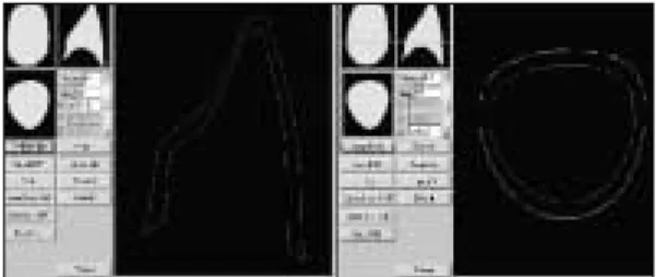 Fig. 10. Master die and completed In-Ceram core Fig. 11. Schematic view of representing measure- measure-ment site   
